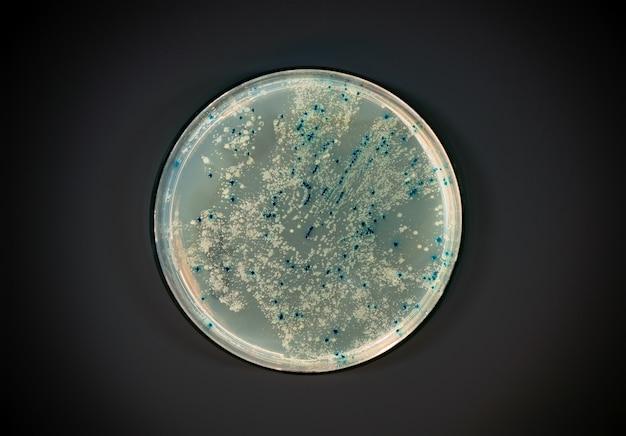 What is the primary use of agar deep? 
