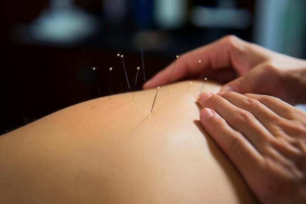 Are veterinarians practice holistic treatments like acupuncture? 