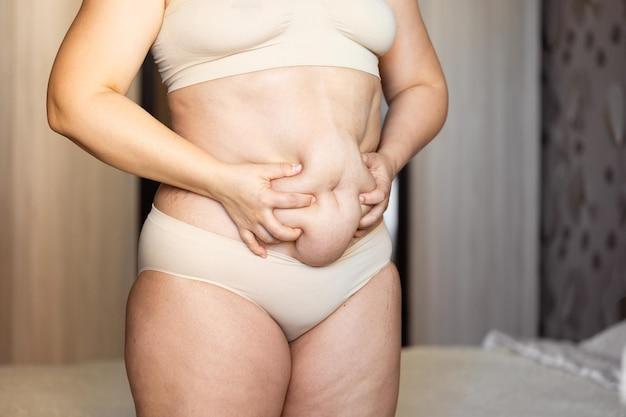 Can ovarian cysts affect weight loss? 