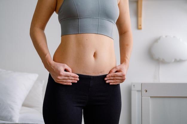 How do you get rid of belly fat from a hernia? 