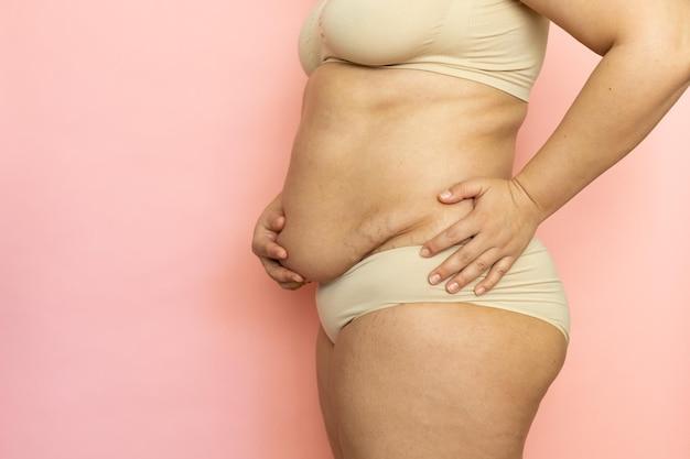 How long after tummy tuck can I stand up straight? 