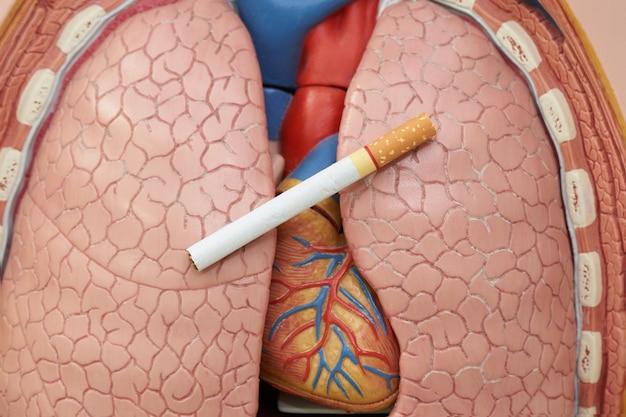 How long after quitting weed do your lungs heal? 