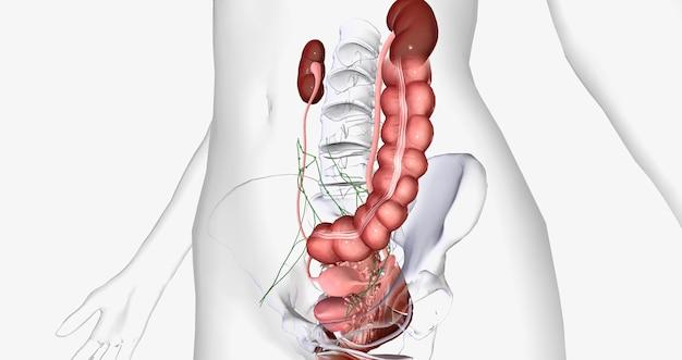 How long does severe pain last after ureteral stent removal? 