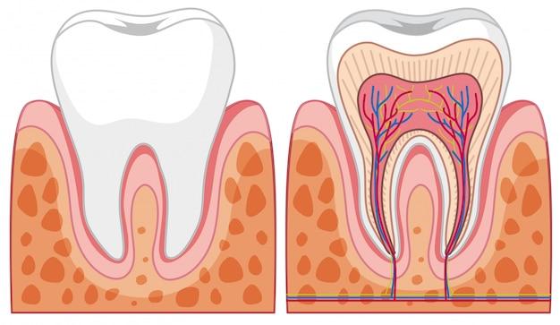 Is it bad to have 7 cavities? 