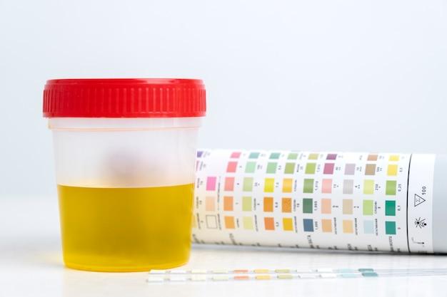 Why would a urine test come back inconclusive? 