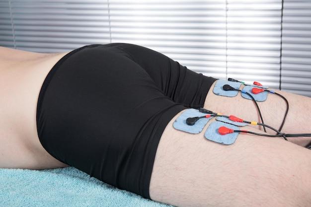 What are 3 types of electrodes? 
