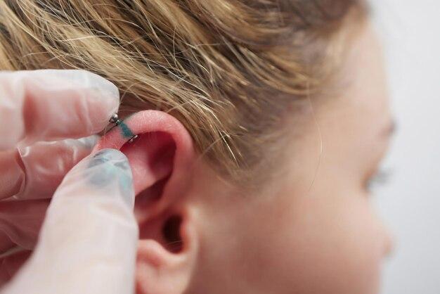 What happens if I take my new cartilage piercing out? 