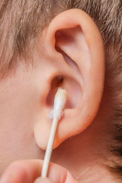 What is the fastest way to get rid of ear wax blockage? 