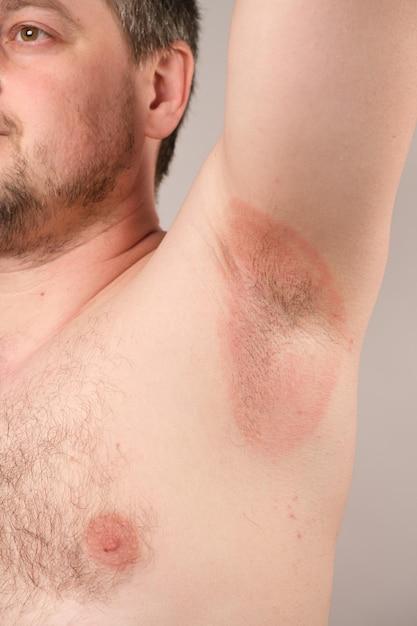 Why does the muscle under my armpit hurt? 