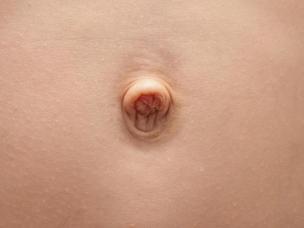 Why is my belly button bleeding male? 